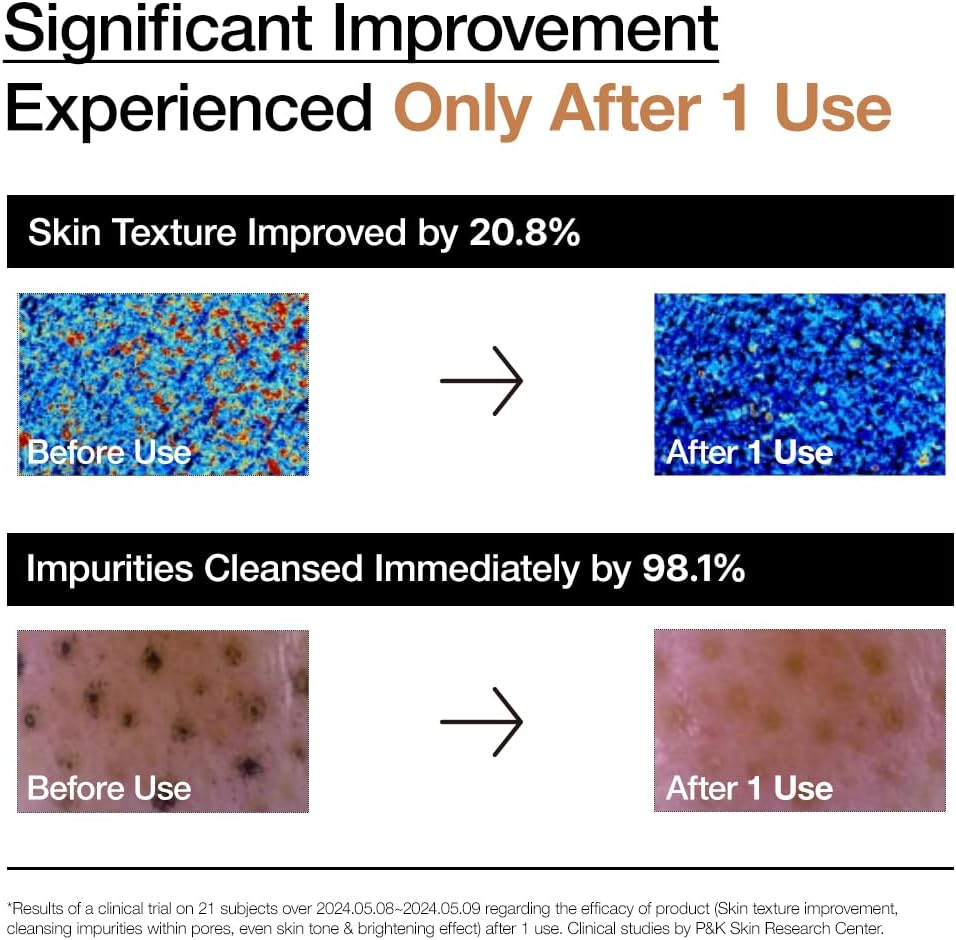 ANUA Rice Enzyme Brightening Cleansing Powder, Fragrance Free, 40g/1.41fl.oz.