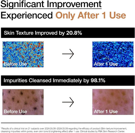 ANUA Rice Enzyme Brightening Cleansing Powder, Fragrance Free, 40g/1.41fl.oz.