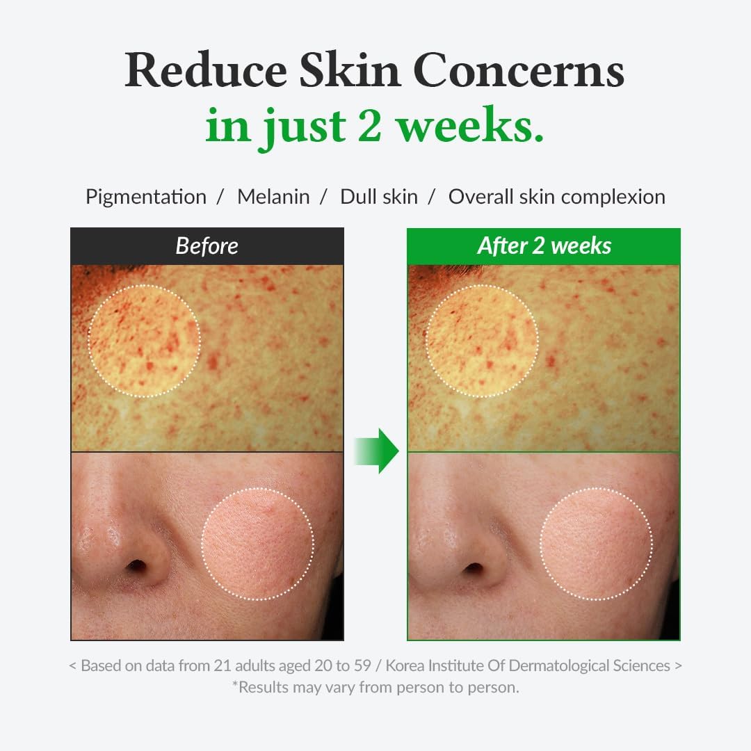 Dr.Althea Gentle Vitamin C Serum | Benefits Skin Tone and Pigmentation for All Skin Types | 30ml