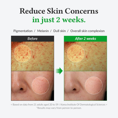 Dr.Althea Gentle Vitamin C Serum | Benefits Skin Tone and Pigmentation for All Skin Types | 30ml