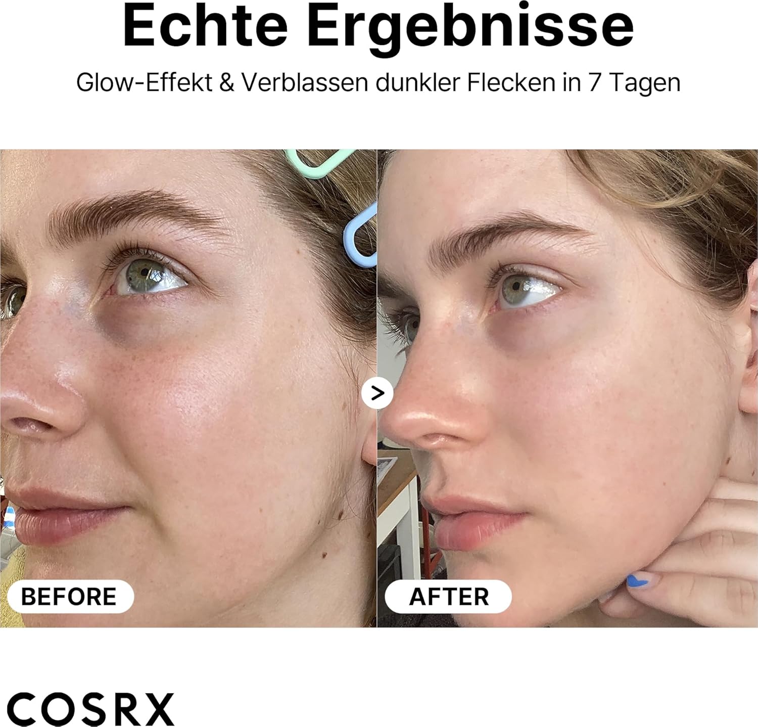 COSRX Pure Vitamin C 23% Serum with Vitamin E & Hyaluronic Acid, Brightening & Hydrating Facial Serum for Fine Lines, Uneven Skin Tone & Dull Skin, Korean Skincare, 0.7oz/20g