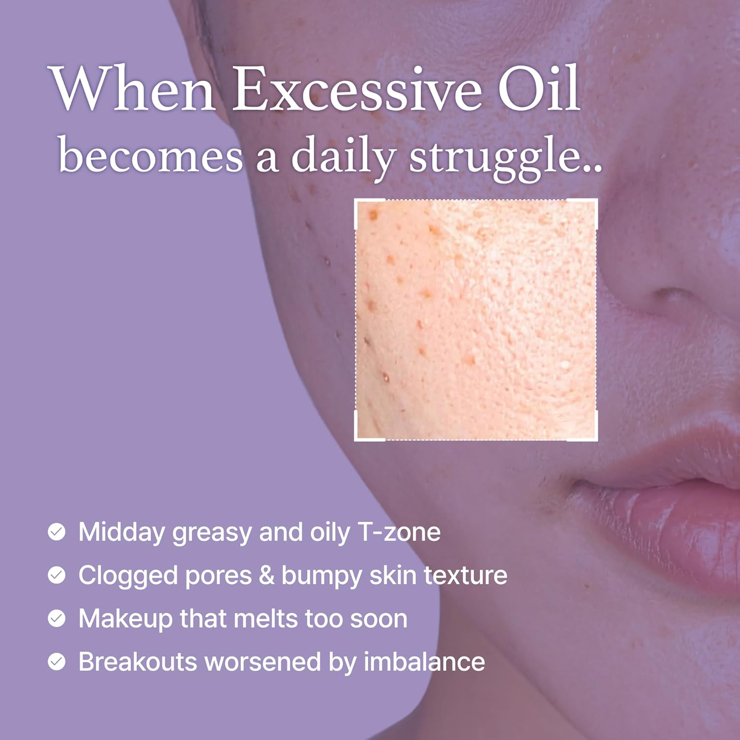 I'm from Black Rice Toner for Oily Skin, 150ml, 5.07 fl.oz