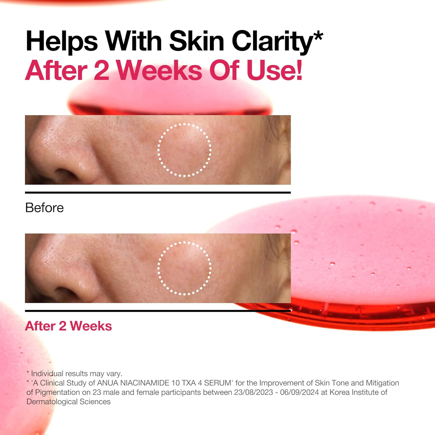 ANUA 10% Niacinamide+ 4% TXA Serum, Fragrance-Free, Dark Spot Serum, 30ml /1.01 fl.oz.