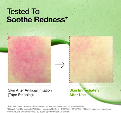 Anua Azelaic Acid 10 Hyaluron Redness Soothing Serum, (30ml/ 1.01 fl oz.)