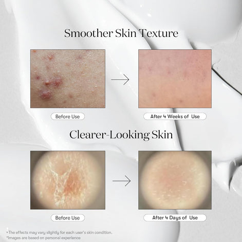 VT COSMETICS CICA Reedle Shot 100, Microneedling Serum for Pore Care & Exfoliation, Exosome, (1.69 Fl Oz / 50ml)