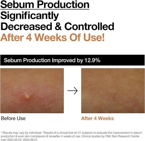 ANUA Rice 70 Glow Milky Toner, for Glass Skin, 250ml/8.45fl.oz.