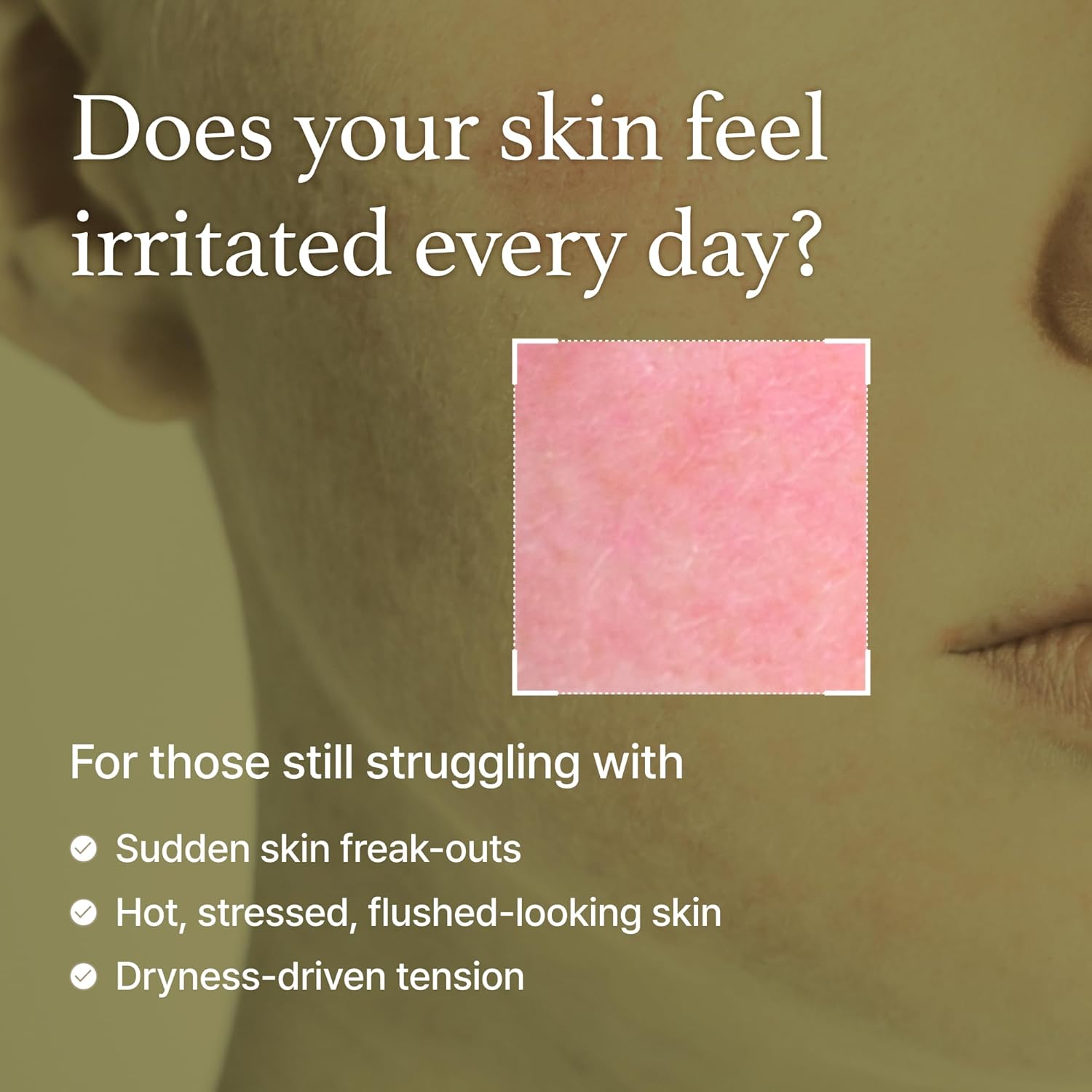 I'm from Mugwort Essence 5.4 Fl Oz | 100% Vegan Mugwort Extract - Soothe Sensitive and Irritated Skin, Redness Relief.