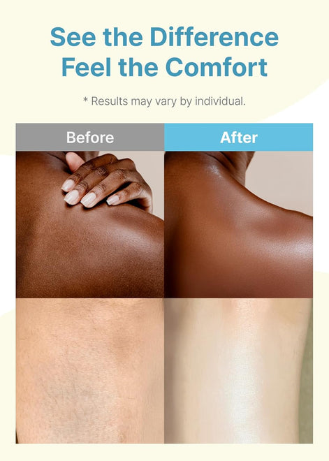 Derma B Daily Moisture Body Oil 99% Natural Argan & Sweet Almond Oil Shower Oil For Dry Sensitive Skin Light & Long-Lasting Hydration Skin Body Care Oil With Peach Scent 6.78 Fl Oz (200 ml)