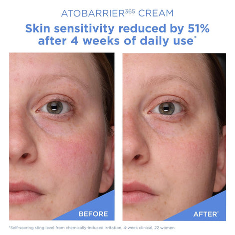 AESTURA ATOBARRIER365 Cream with Ceramides, 80 mL / 2.70 fl.oz.